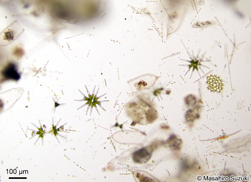 河口で採集された淡水産プランクトン